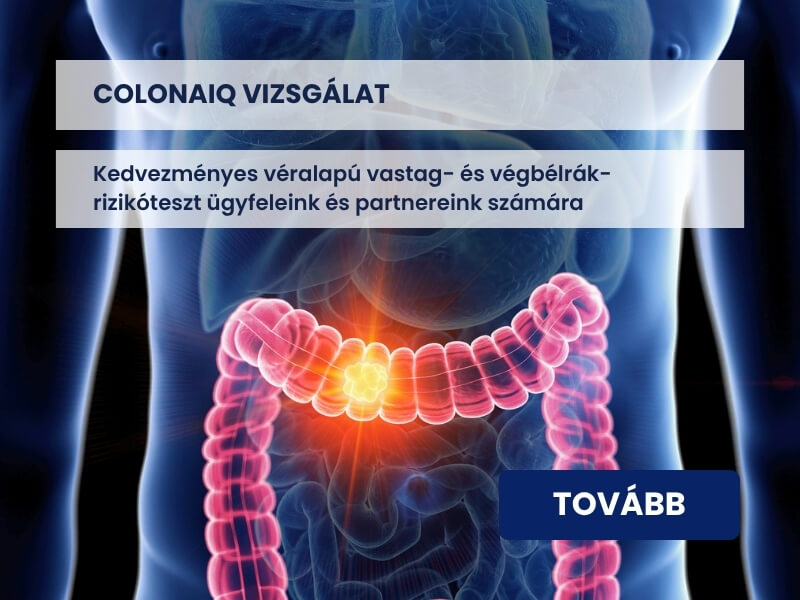 ColonAIQ
